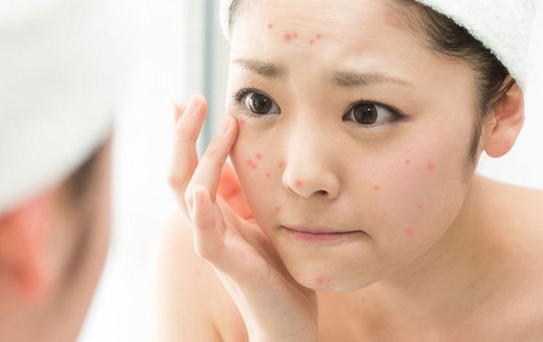 Cùng Fine Plus tìm hiểu các bệnh lý về da phổ biến hiện nay