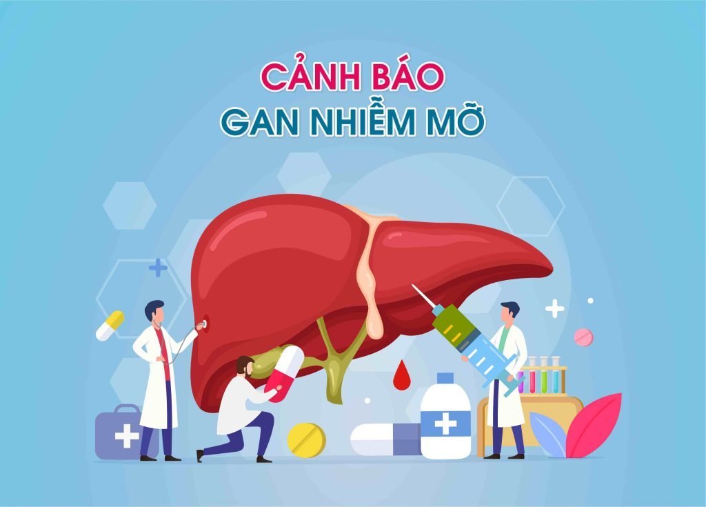 Gan nhiễm mỡ: Nguyên nhân, Triệu chứng và Cách phòng ngừa