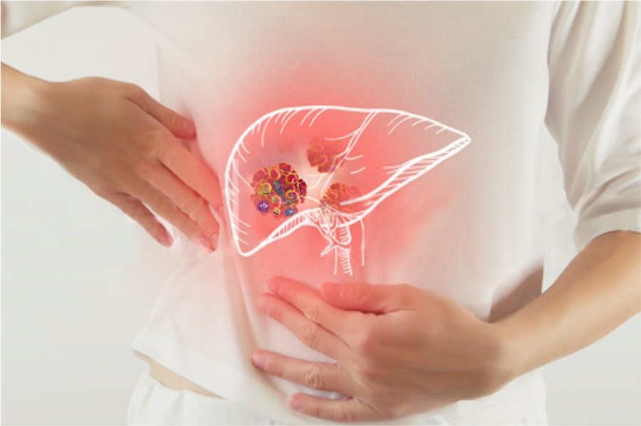Những dấu hiệu nhận biết khi lá gan bạn đang quá tải