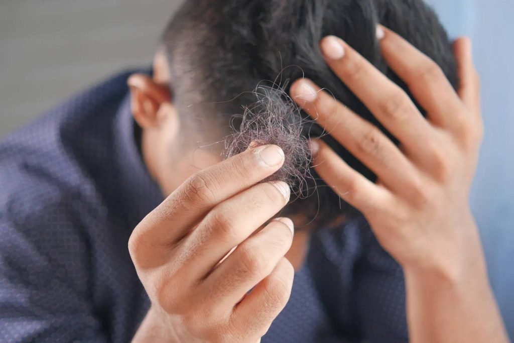 Cùng Fine Plus tìm hiểu nguyên nhân gây rụng tóc ở nam giới và cách khắc phục