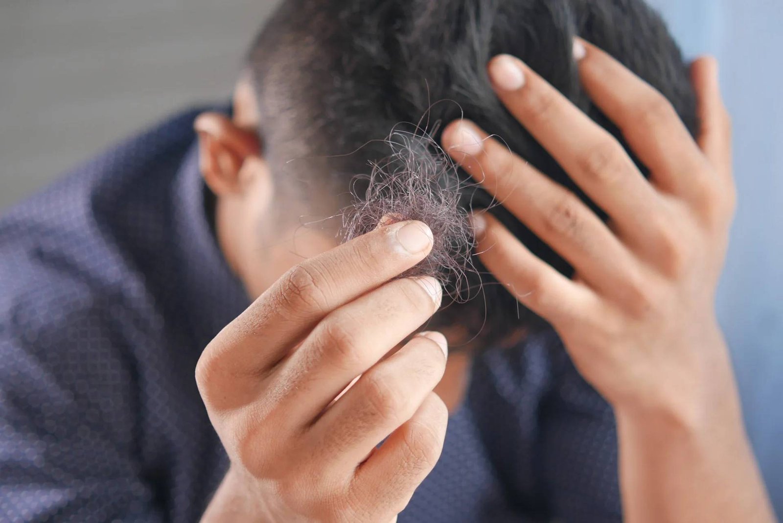 Cùng Fine Plus tìm hiểu nguyên nhân gây rụng tóc ở nam giới và cách khắc phục